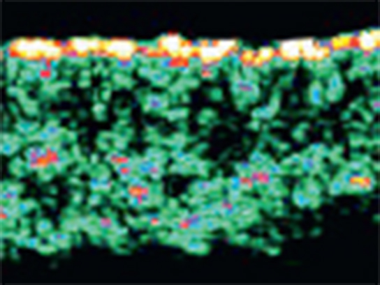 Before scan